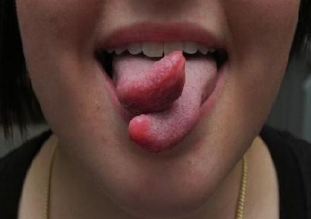 Keistos plastinės operacijos: nuo elfo ausų iki gyvatės liežuvio (foto)