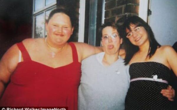 Pavojingi kraštutinumai: iš storulės – į anoreksikę (foto)