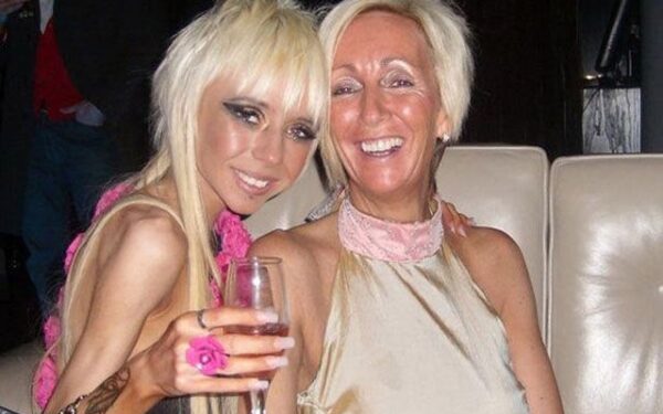 Anoreksikė pradėjo gydytis po to, kai jos vos nesuvažinėjo mašina (foto)