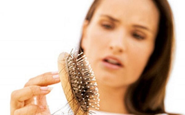 Plaukų slinkimo priežastys ir stabdymas