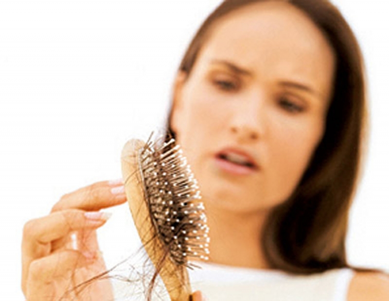 Plaukų slinkimo priežastys ir stabdymas