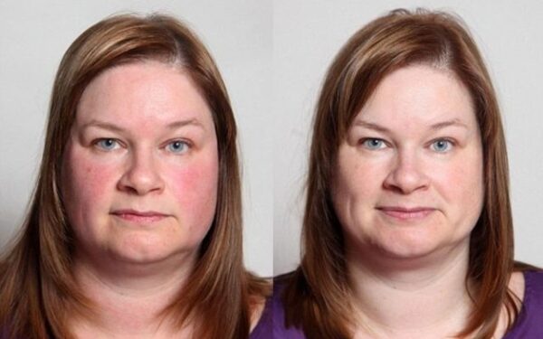 Eksperimentas: kaip alkoholio atsisakymas pakeitė moters išvaizdą (foto)