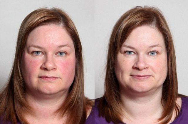 Eksperimentas: kaip alkoholio atsisakymas pakeitė moters išvaizdą (foto)