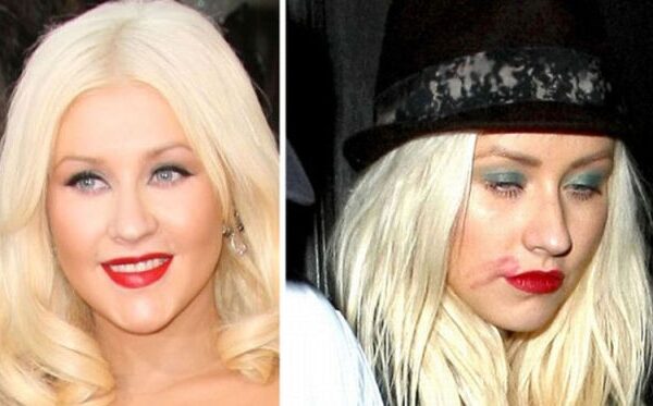 Girtos ir blaivios: kaip įžymybės atrodo geriau? (foto)