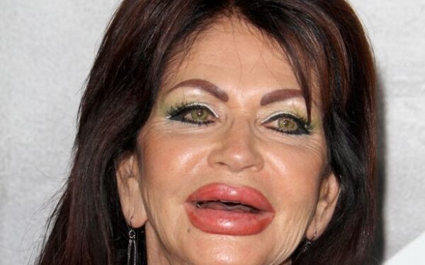 Aktoriaus Sylvesterio Stallone mama Jackie apie plastines operacijas: atrodau kaip burundukas