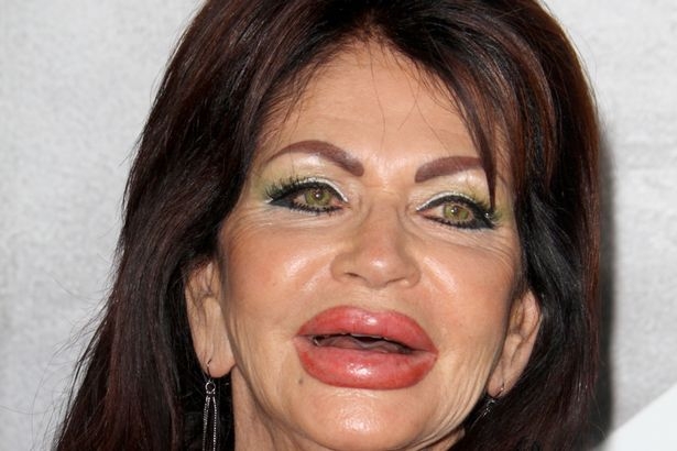 Aktoriaus Sylvesterio Stallone mama Jackie apie plastines operacijas: atrodau kaip burundukas