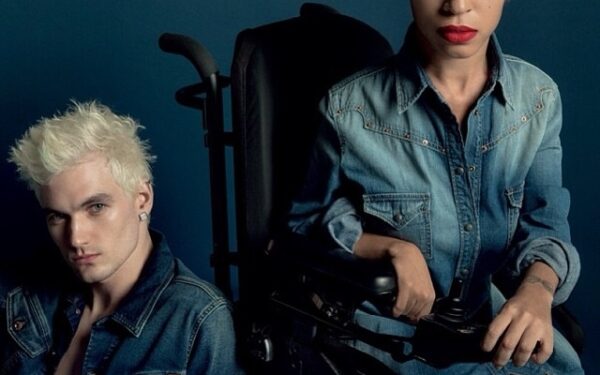 Įkvepianti istorija: nuo raumenų distrofijos kenčianti mergina tapo modeliu!