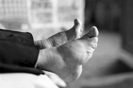 Grožio aukos: paskutinės pėdų mažinimo tradicijos Kinijoje liudininkės (foto)