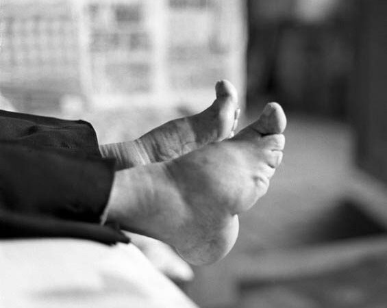 Grožio aukos: paskutinės pėdų mažinimo tradicijos Kinijoje liudininkės (foto)