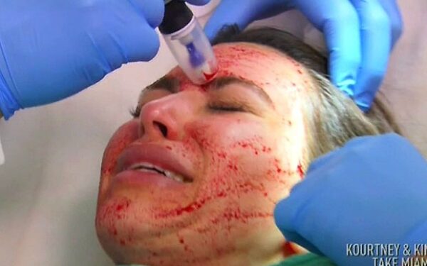 Skausmingos Kim Kardashian grožio aukos (foto)