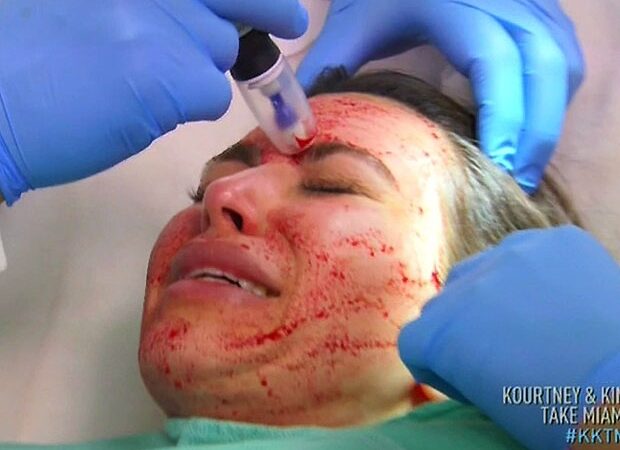 Skausmingos Kim Kardashian grožio aukos (foto)