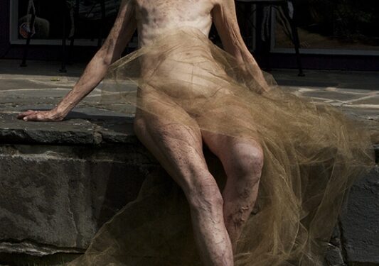 Gražios: pribloškiantys krūties vėžį nugalėjusių moterų portretai (N-18, foto)