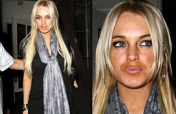 Kai įžymybės perdozuoja savaiminio įdegio kremo… (foto)