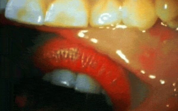 Valgydami nežiūrėkite: vaikinas įsidėjo į burną kamerą, kad nufilmuotų bučinį