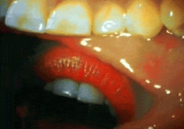 Valgydami nežiūrėkite: vaikinas įsidėjo į burną kamerą, kad nufilmuotų bučinį