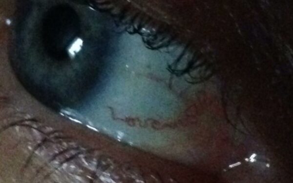 Būna ir taip: moters akies obuolyje kraujagyslės sudėliojo žodį „Meilė“ (video)