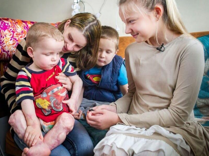Į žaibinės meningokokinės infekcijos gniaužtus pakliuvęs mažylis trokšta džiaugtis vaikyste