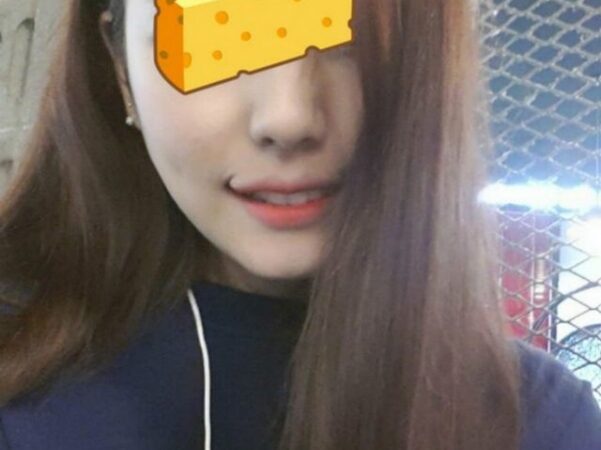 Šypsokis kad ir kas benutiktų: nauja plastinių operacijų mada Pietų Korėjoje (foto)