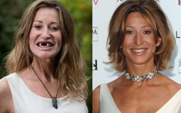 Nutinka ir taip – žymus modelis per avariją neteko priekinių dantų