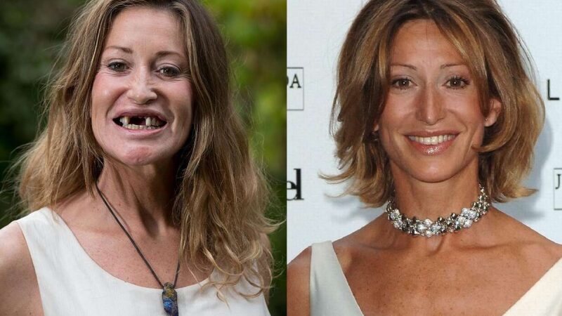 Nutinka ir taip – žymus modelis per avariją neteko priekinių dantų