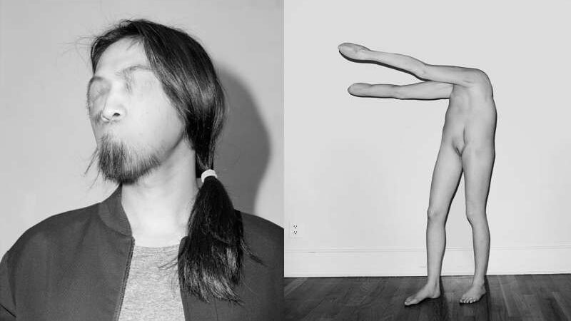 A. Carlseno fotografija – vardan meno suniokotas žmogus (Foto)