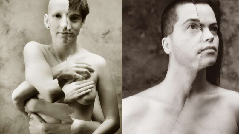 Fotografo B. N. Adamso chirurginiai montažai (Foto)