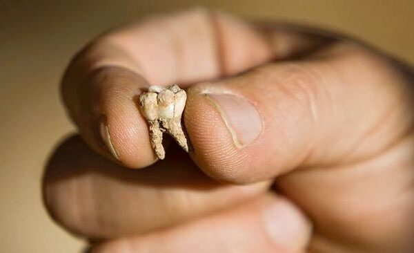 Ar žinojote? Dantų implantų evoliucija