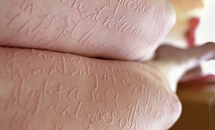 Kai trūkumai tampa pranašumais arba kai labai labai jautri oda tampa menu (foto)