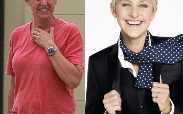 Produktus prieš senėjimą pristatanti žvaigždė atrodo kaip susiraukšlėjusi senolė (foto)