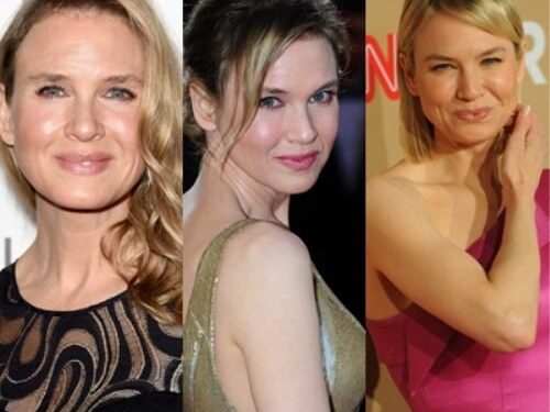 Kardinaliai pasikeitusi Renee Zellweger pakomentavo savo išvaizdos pokyčius (foto)