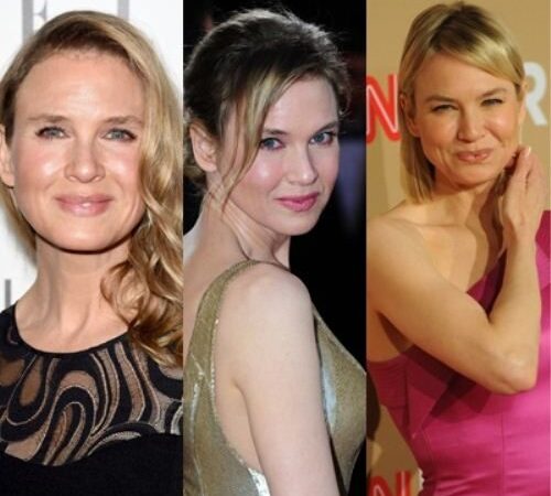 Kardinaliai pasikeitusi Renee Zellweger pakomentavo savo išvaizdos pokyčius (foto)
