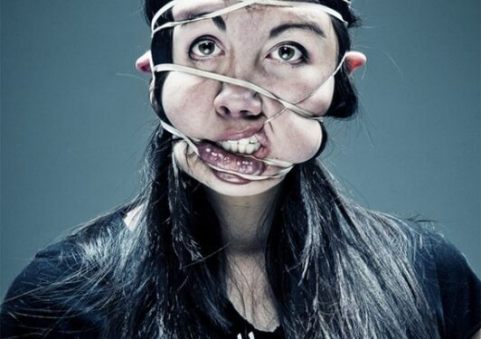 Dar daugiau gražių žmonių veidų deformacijų (foto)