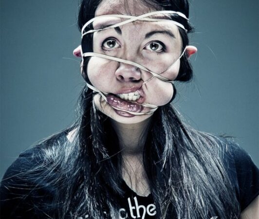 Dar daugiau gražių žmonių veidų deformacijų (foto)