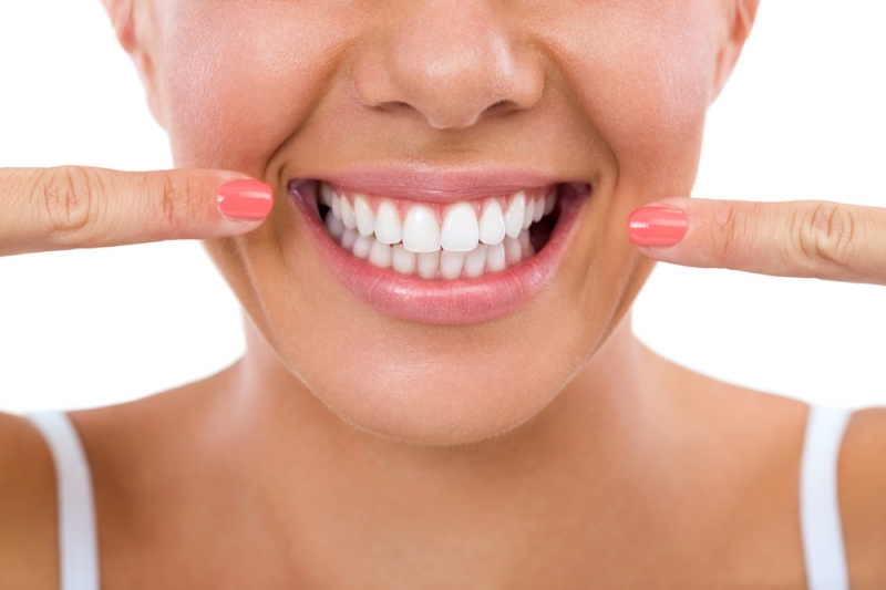 Dantų balinimas: 3 populiariausi mitai