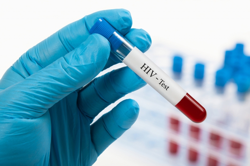 Prof. V. Šikšnys: „AIDS išgydymas yra tik laiko klausimas“