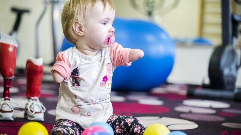 Be rankyčių ir kojyčių gimusiai mažajai Sofijai „Išsipildymo akcija“ dovanos šviesesnę ateitį