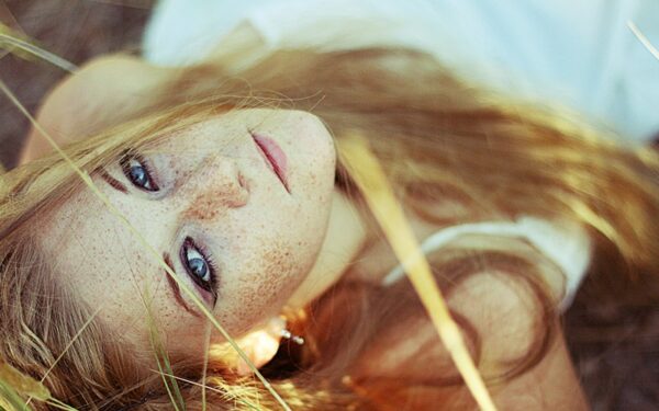 Kaip pašviesinti strazdanas?