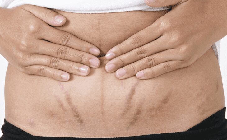 Strijos – priešas, su kuriuo kovoti reikia nedelsiant