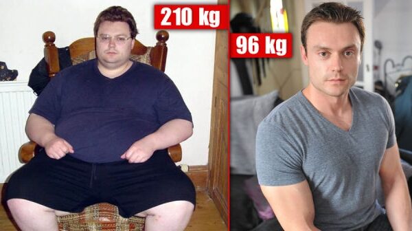 Po nesėkmingo bandymo nusižudyti – stulbinami išvaizdos pokyčiai (foto)