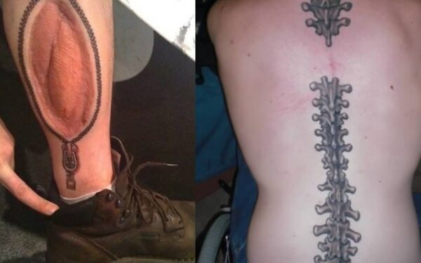 Tatuiruotėmis pridengti kūno randai (foto)