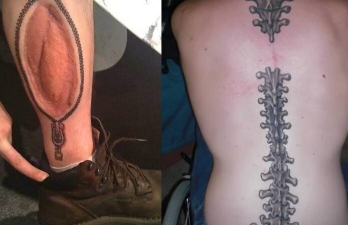 Tatuiruotėmis pridengti kūno randai (foto)