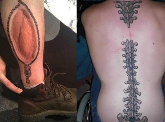 Tatuiruotėmis pridengti kūno randai (foto)