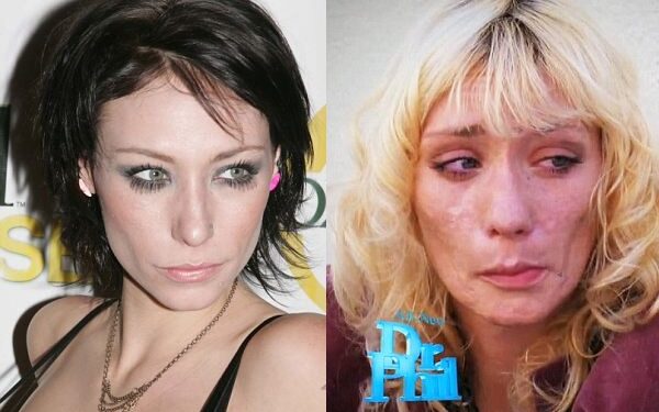 Metamfetamino pasekmės: sugriautas „America’s Next Top Model“ dalyvės gyvenimas