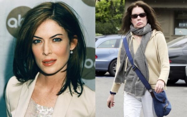 Istorija kartojasi: plastinės operacijos neatpažįstamai subjaurojo aktorę (foto)