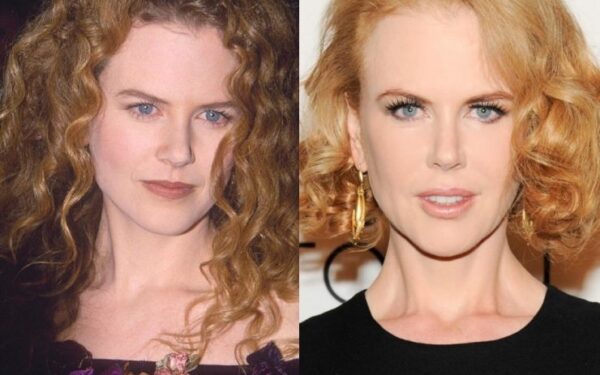 Nesenstantis grožis: Nicolės Kidman metamorfozės per 20 metų (foto)