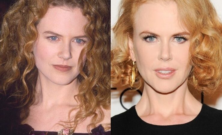 Nesenstantis grožis: Nicolės Kidman metamorfozės per 20 metų (foto)
