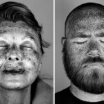 Nepagražinti portretai atskleidė saulės daromą žalą mūsų odai (foto)