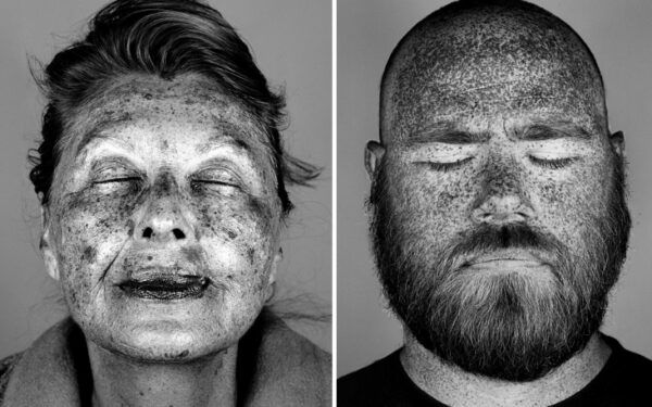 Nepagražinti portretai atskleidė saulės daromą žalą mūsų odai (foto)