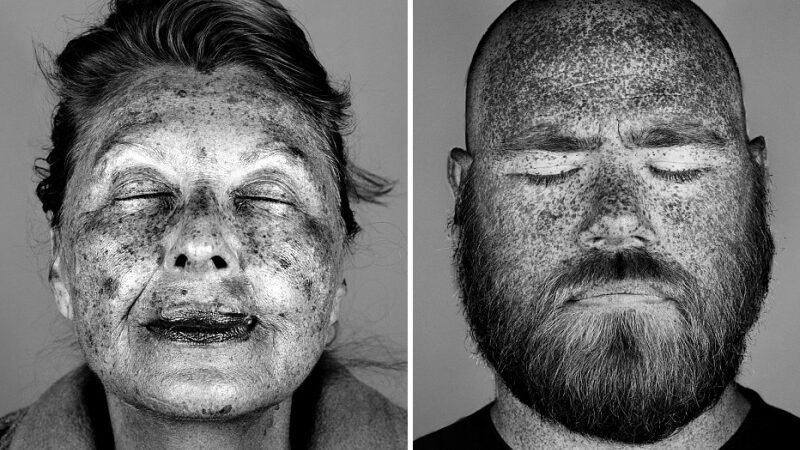 Nepagražinti portretai atskleidė saulės daromą žalą mūsų odai (foto)