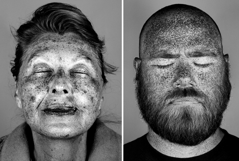 Nepagražinti portretai atskleidė saulės daromą žalą mūsų odai (foto)